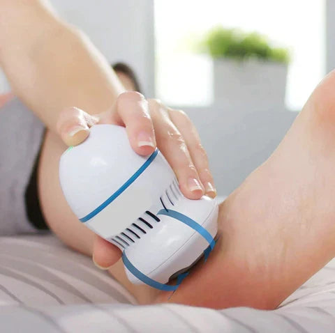 Layla Vacuum Callus Remover